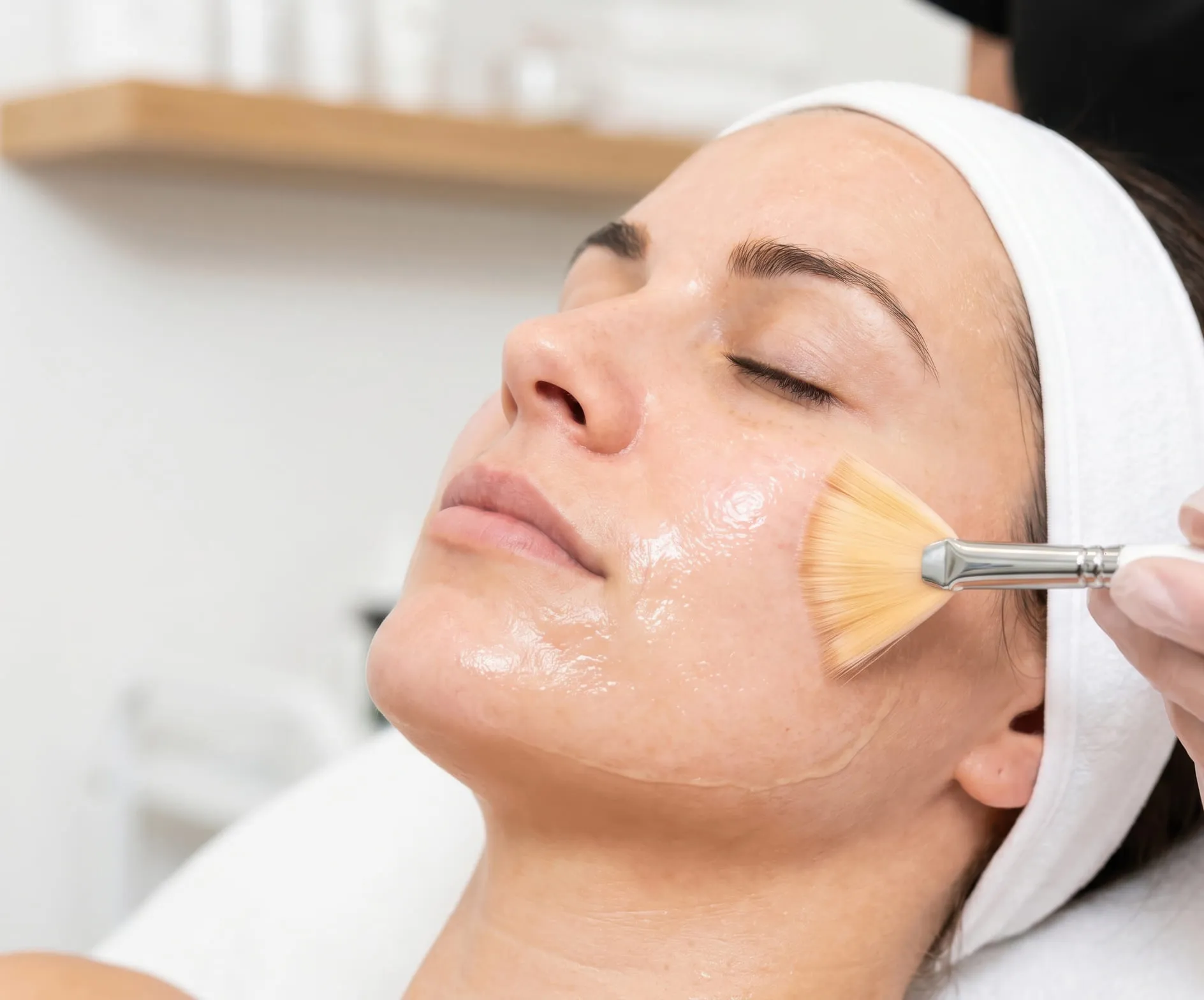 Personalized treatment options for acne