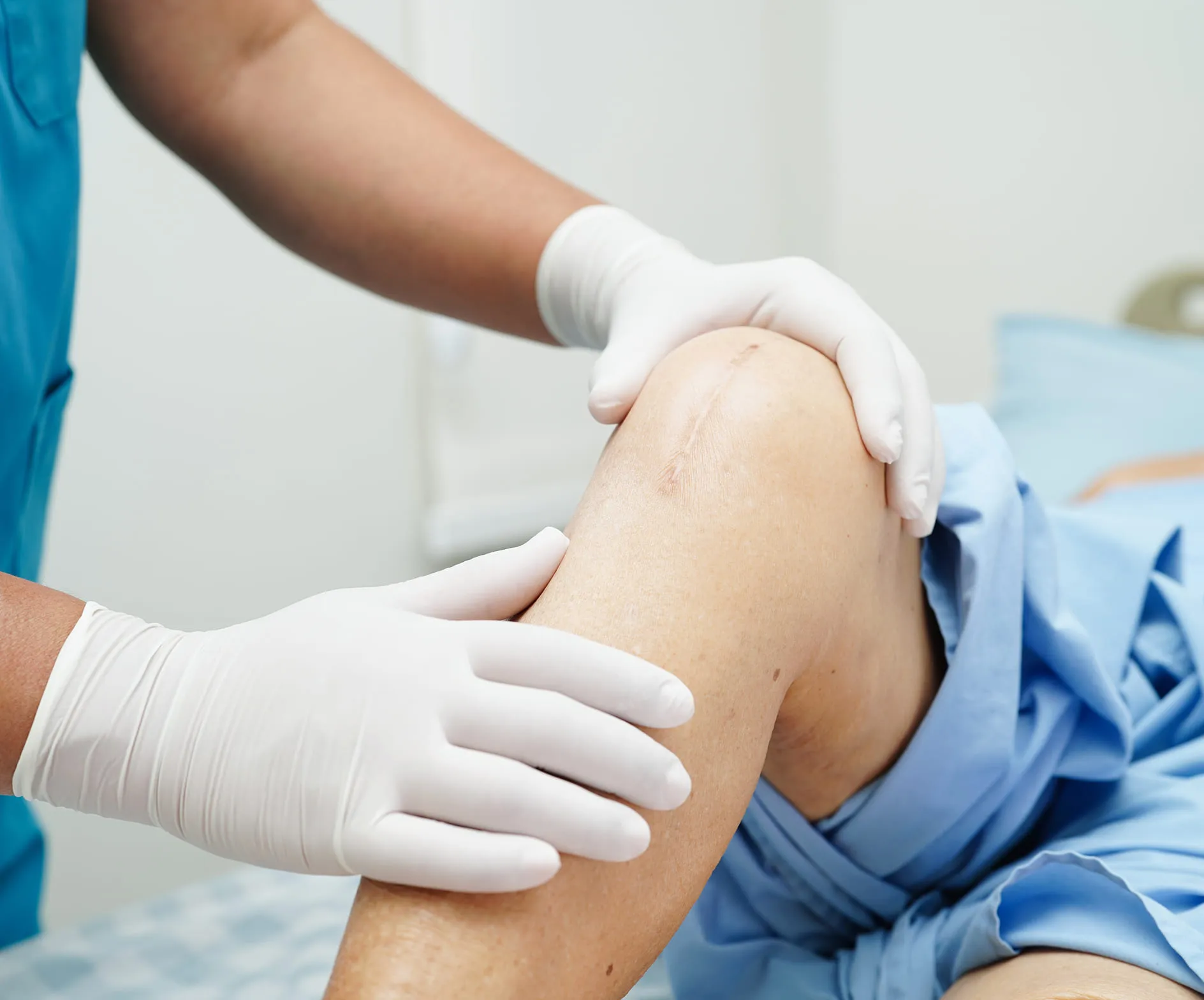 Advanced Techniques for Scar Revision
