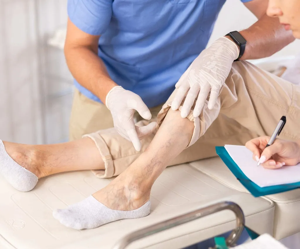 The benefits of sclerotherapy