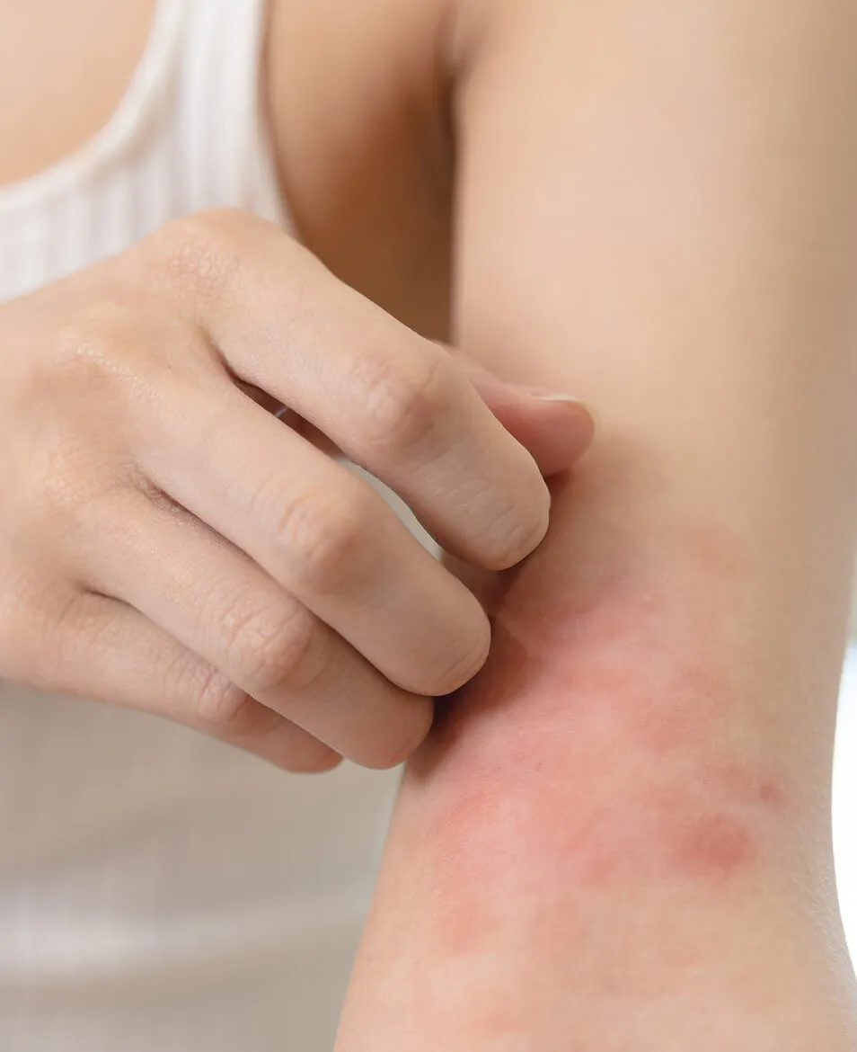 Medical dermatology